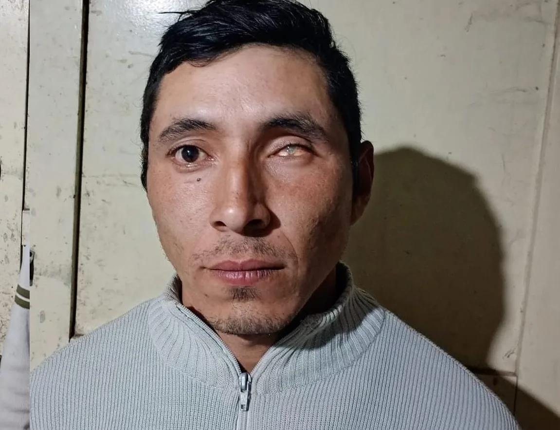 Necesita $1 millón para una prótesis y lanzó una campaña solidaria: cómo ayudarlo