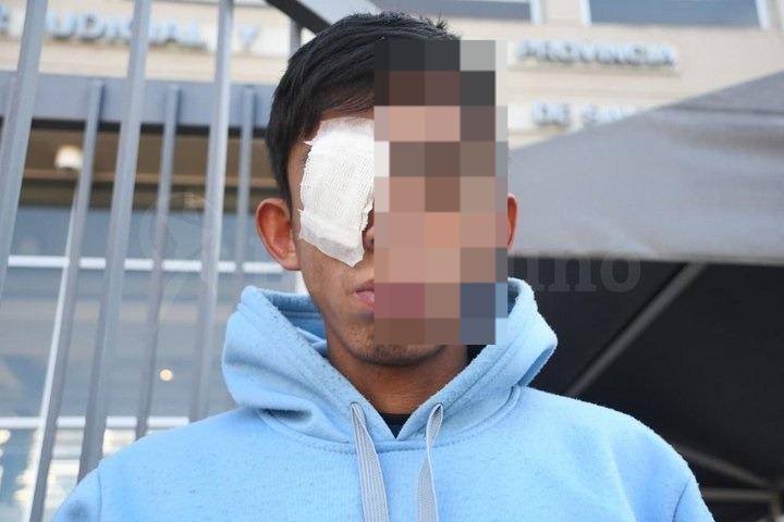 Investigan brutal ataque a un adolescente de 15 años: le dispararon en el rostro con una tumbera