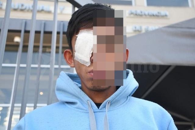 Investigan brutal ataque a un adolescente de 15 años: le dispararon en el rostro con una tumbera
