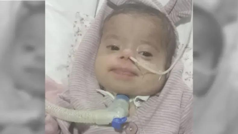 Murió Emilia, la beba sanjuanina de 4 meses que esperaba una cirugía del corazón