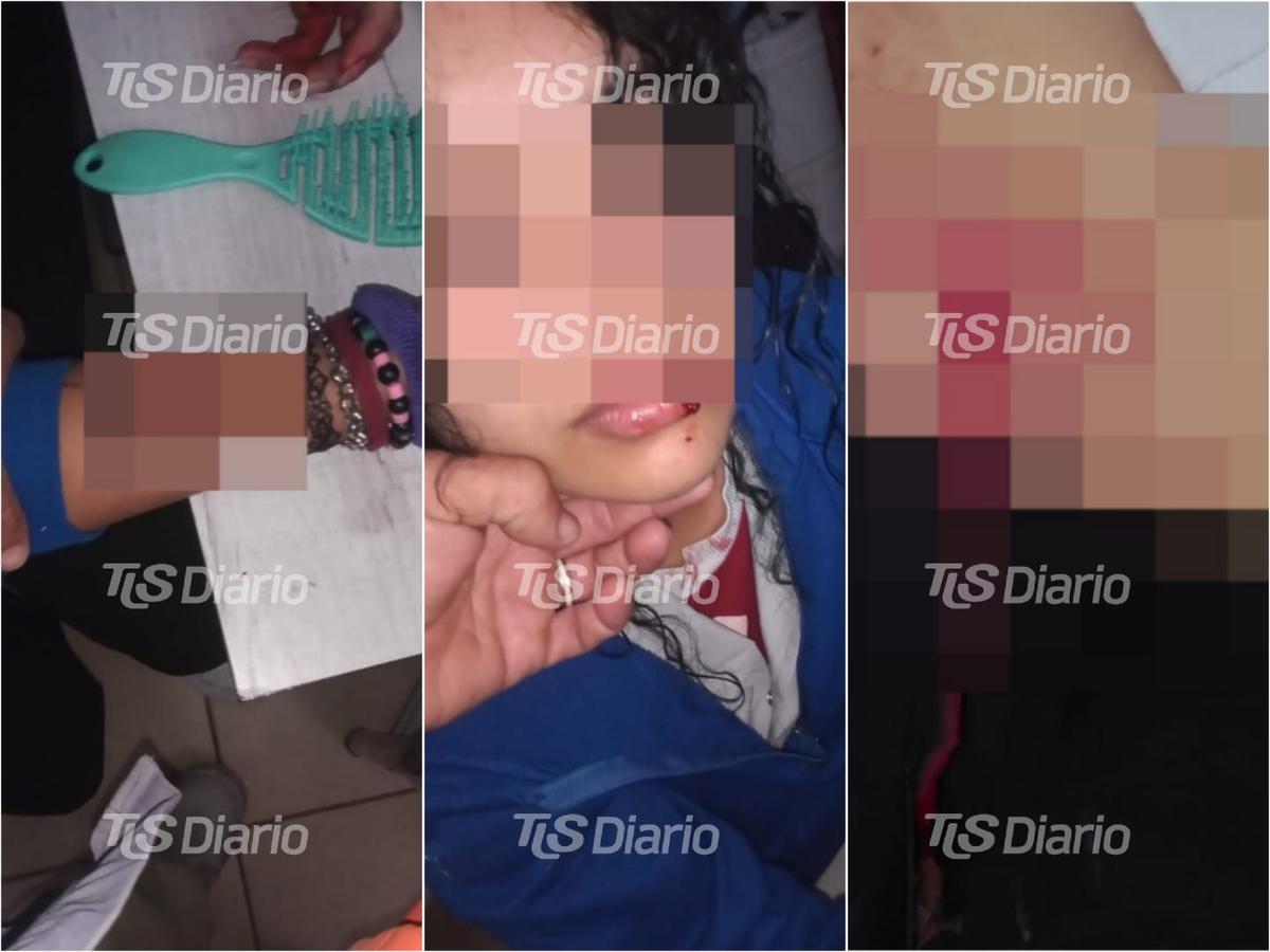 Brutal asalto a una chica de 17 años en una parada de colectivo de Rawson