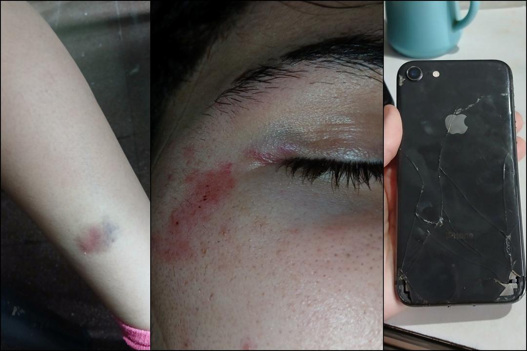 Un relato en redes sobre un robo y una agresión generó impacto en Rivadavia