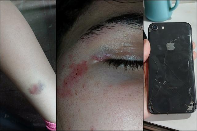 Un relato en redes sobre un robo y una agresión generó impacto en Rivadavia