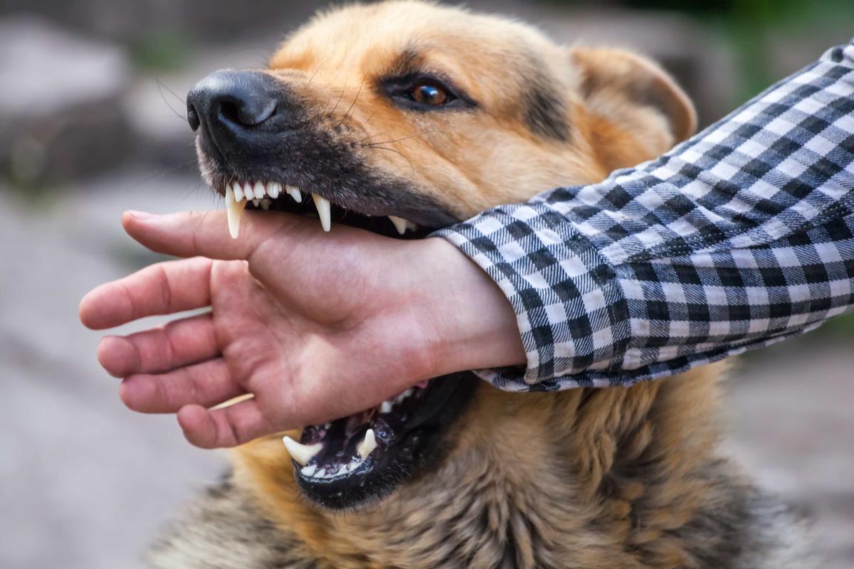 Un perro mordió a un hombre en Rawson y terminó con una amputación