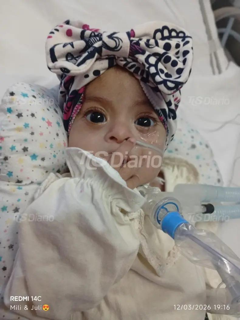 Falleció Julieta Ámbar Jofré, la beba sanjuanina cuya historia generó una amplia cadena de apoyo