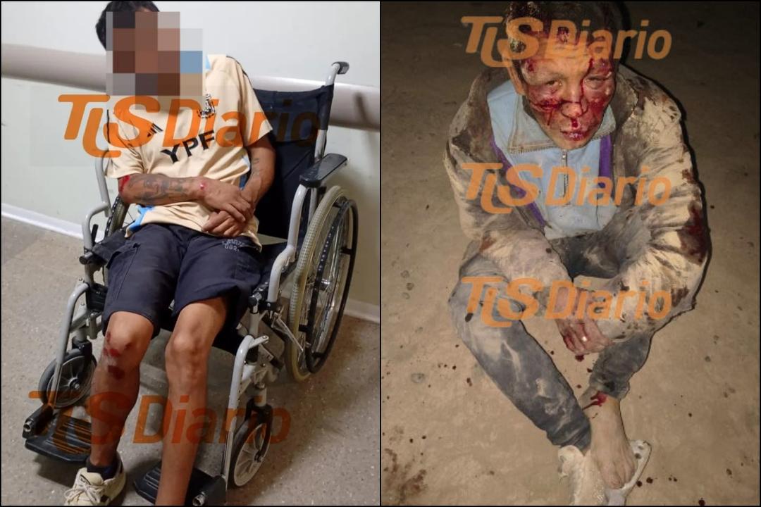 Un hombre de 37 años volvió a ser agredido por vecinos tras un nuevo robo en Chimbas