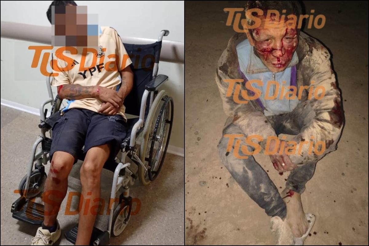 Un sanjuanino volvió a ser castigado por vecinos tras un nuevo robo en Chimbas