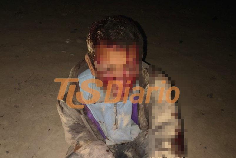 Entró a una casa y terminó reducido a golpes por los vecinos