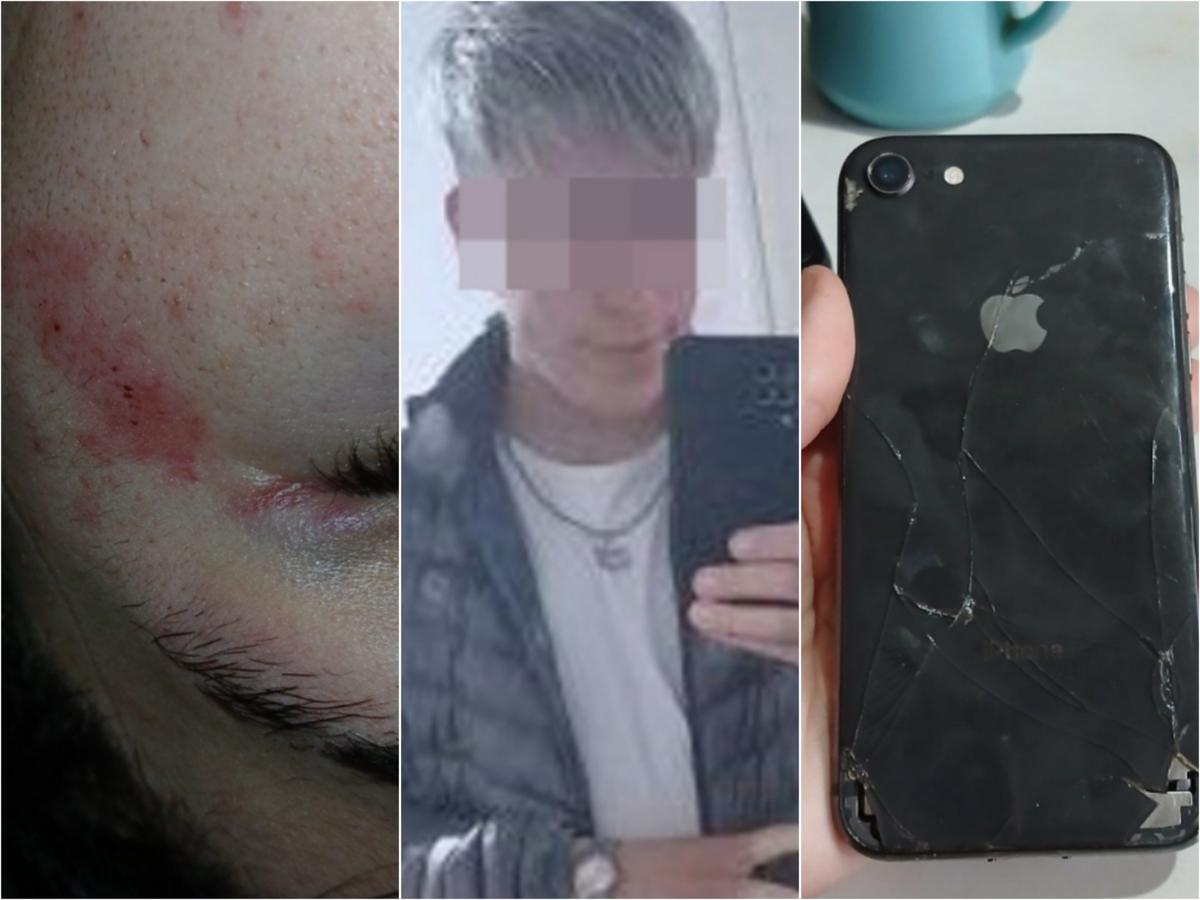 Una joven acusó a un hombre del Barrio Aramburu por un robo y un ataque a piedrazos