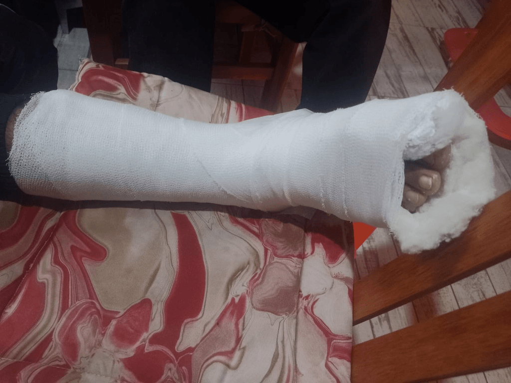 Acusan a policías de golpear a un joven y dejarlo con tres fracturas en una comisaría sanjuanina