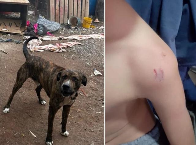 Un niño de 3 años sufrió heridas graves tras el ataque de un perro en Rawson